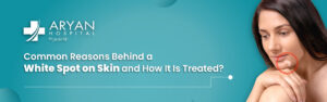 Common Reasons Behind a White Spot on Skin and How It Is Treated